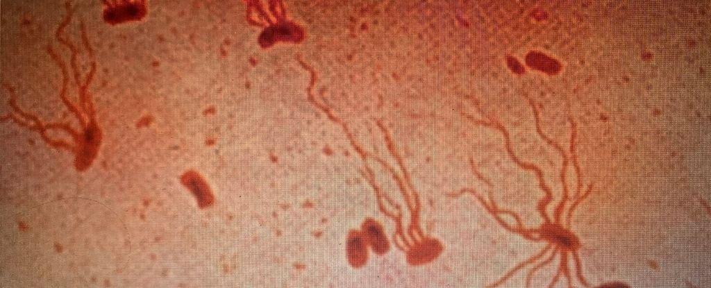 Ancient murderers are against antibiotics, warning, warning: